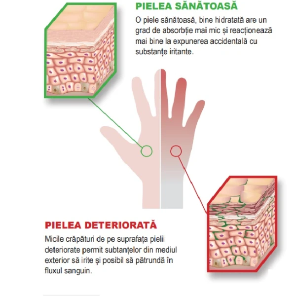 Crema hidratanta profesionala pentru ingrijirea mainilor Gojo Hand Medic 8150, 148 ml, hidrateaza si previne uscarea si craparea pielii